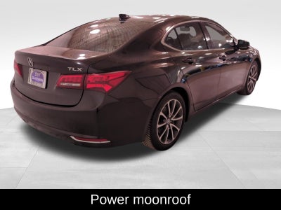 2015 Acura TLX V6 Tech
